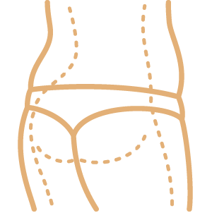 Vajinoplasti
